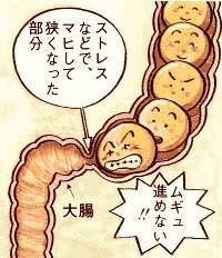 けいれん性便秘.jpg