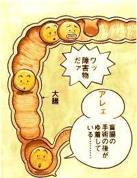 器質性便秘.jpg
